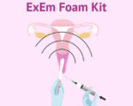 Procedura con ExEm® Foam vs. HSG